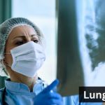 Lung Cancer and its types