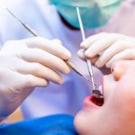 Sabka Dentist - Top Dental Clinic Chain in India