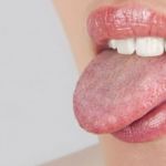 How to Cure Mouth Ulcers Fast Naturally: Nature's Fast Track to Relief