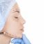 Dark Circles Botox Filler In Alameda County