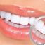 Teeth Whitening Penrith